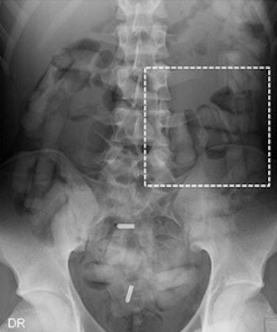 2011 12 23 09 30 25 680 2011 12 22 Drugs4