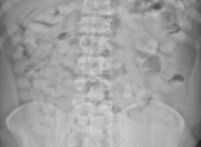 2011 12 23 09 43 09 490 2011 12 22 Drugs1b