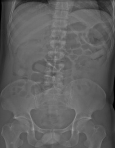 2011 12 23 10 02 12 909 2011 12 22 Drug6