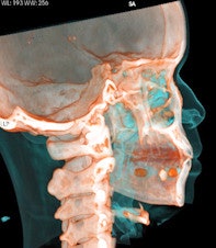 3D reconstruction
