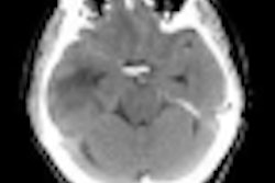 2012 04 10 14 15 31 116 Thumb