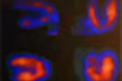 2012 01 11 13 28 40 496 2012 01 11 Spect