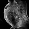2012 01 12 13 10 49 34 2012 01 Xx Fetal Mri Thumb