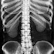 2012 01 13 12 44 40 537 Abdominal X Ray 70