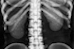 2012 01 13 12 44 40 537 Abdominal X Ray 70