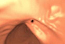 2012 01 20 09 07 03 541 2012 01 17 15 44 19 586 Slabaugh Nearmiss Thumb