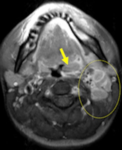 2012 01 23 12 46 09 347 2012 01 24 Tularemia 1c