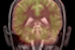 2012 01 25 12 23 38 759 Pet Mri Thumb