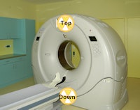 Scheme of possible tube position for scout views on a 320-detector-row CT (Aquilion One, Toshiba). It can be above ('top') or below ('down') the CT couch.
