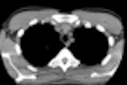 2012 01 30 11 26 59 174 2012 01 30 Ct In Children Thumb