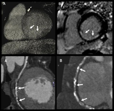 2012 01 30 13 27 26 366 Weininger semiquant bottom
