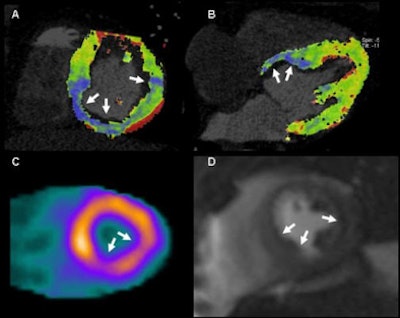 2012 01 30 13 27 32 774 Weininger 51yo bottom