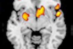 2012 02 16 11 38 20 272 2012 02 17 Gray Matter Thumb