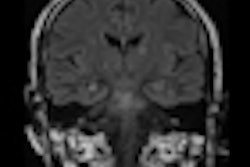 2012 02 23 09 09 29 243 2012 02 23 Stroke