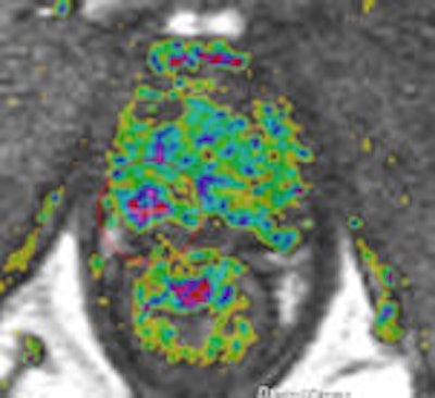 Axial dynamic contrast-enhanced MRI