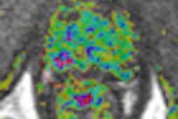 2012 02 24 00 53 01 192 2012 02 24 Prostate Mri 6b2
