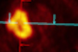 2012 02 27 13 15 16 592 2012 02 29 Perfusion Ct Thumb