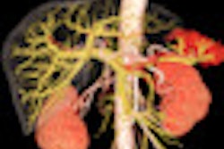 2012 02 28 11 34 31 971 2012 02 29 Abdomen 3 D