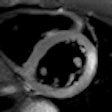 2012 02 27 15 02 18 527 2012 03 01 Cardiac Mri Thumb