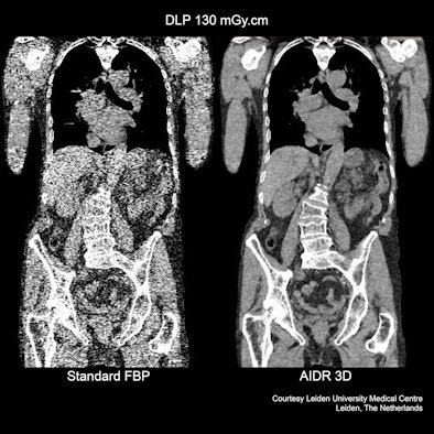 2012 02 27 15 24 43 676 Toshiba Ct 394