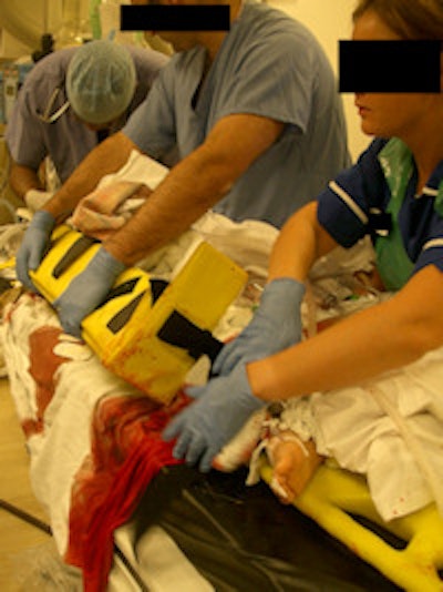 An injured 14-year-old boy is transferred by the resuscitation team in the x-ray department. Image courtesy of Dr. David Kessel.
