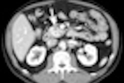 2012 02 27 16 50 42 366 2012 03 01 Pancreas Thumb