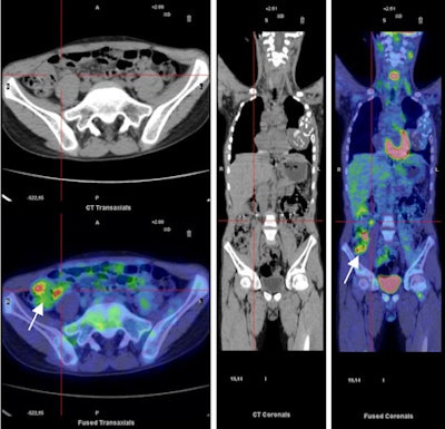 2012 02 28 14 16 40 149 P13 Thursday Pc3 Figure 3 450