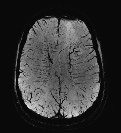 2012 02 28 15 35 39 355 P10 Saturday Rc1113 Ecr Fig1 394