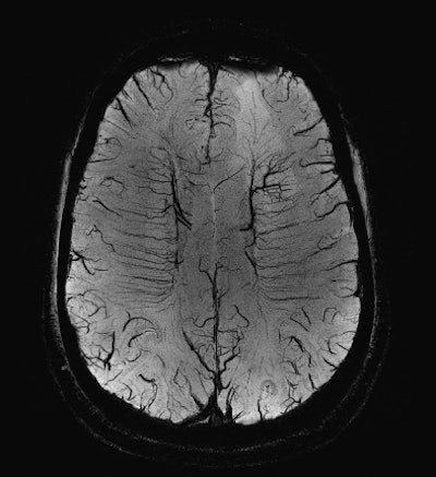 2012 02 28 15 35 39 355 P10 Saturday Rc1113 Ecr Fig1 394