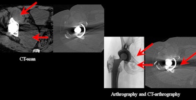 2012 02 28 17 50 29 774 Pelvic Collection 450