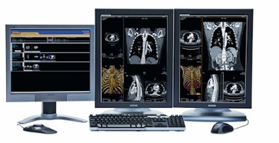 2012 02 28 18 57 50 7 Philips Intellispace P Acs 450