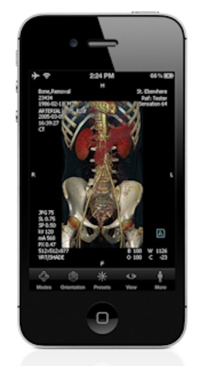 Volume-rendered CT angiogram is displayed with syngo.via WebViewer. (Provided by Siemens)