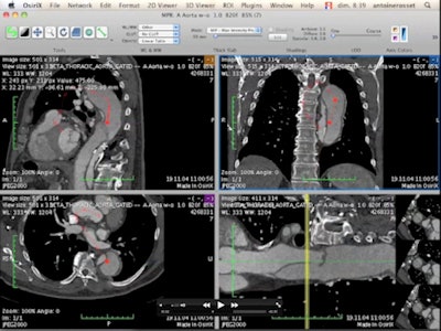 2012 02 29 14 36 43 752 Screen Shot2012 01 16at15 49 450