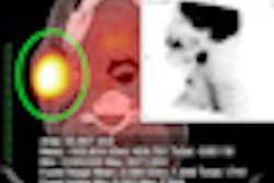 2012 02 29 14 36 44 202 Petct 02 Thumb