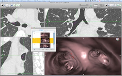 2012 02 29 14 36 46 231 Endoscopy 02 450