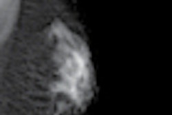 2012 03 03 15 58 47 558 Photon Microdose Thumb