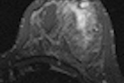 2012 03 13 11 26 29 965 Stir T2 W Axial Thumbnail Brosky 70 V2