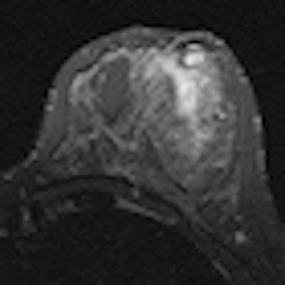 2012 03 13 11 26 29 965 Stir T2 W Axial Thumbnail Brosky 70 V2