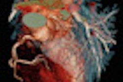2012 03 14 09 23 33 5 Somatom Definition Flash Heart Thumb