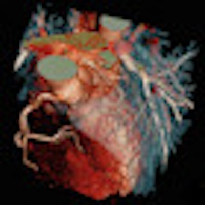 2012 03 14 09 23 33 5 Somatom Definition Flash Heart Thumb