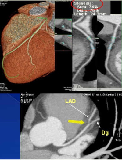 47-year-old asymptomatic patient