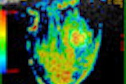 2012 03 27 15 32 49 865 2012 03 26 Martincich Fig1 B Thumb