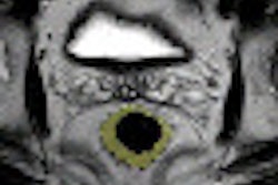 2012 03 28 12 03 54 784 2012 03 29 Volumetric Mri Thumb