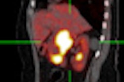 2012 03 29 11 29 42 547 2012 03 30 Ictr Phe Thumb