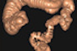 2012 03 30 14 32 02 644 Rizzati thumb 04 Comp