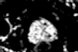 2012 04 09 13 09 33 206 2012 04 10 Prostate Mri Thumb