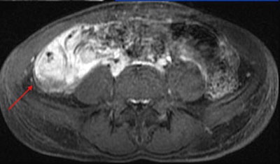 2012 04 10 11 06 15 124 2012 04 11 Mr Grand long segment terminal middle