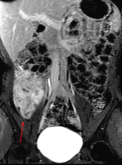 2012 04 10 11 06 17 85 2012 04 11 Mr Grand long segment terminal bottom