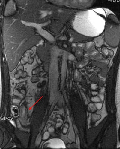 2012 04 10 11 06 20 567 2012 04 11 Mr Grand active mild bottom