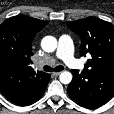 2012 04 11 12 18 08 248 2012 04 12 Safire Martine chest safire bottom